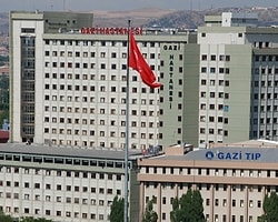 Üçüncü Yüz Nakli İçin Kollar Sıvandı!