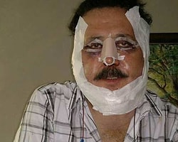 Bu Ünlüyü Tanıyabildiniz Mi?