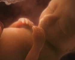 18 haftalık ceninin gen haritasına ulaşıldı