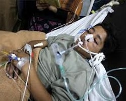 Pakistan'da Kızamık Hastalığından 210 Çocuk Öldü