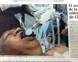 Chavez'in Sahte Fotoğrafı Gazete Toplattı