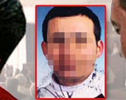 Derisinin Altından Penis Çıktı