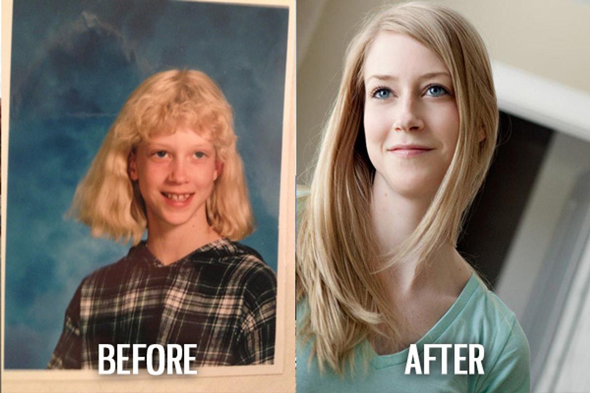 Изменился но не заметить. Подростки до и после. Изменение внешности подростков. Некрасивый подросток стал красивым. Подростки до и после взросление.