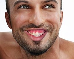 Türk Ünlülerin Ağızları Ronaldinho'nun Ağzı ile Yer Değiştirseydi..