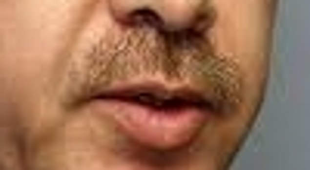 Recep Tayyip Erdoğan Ağzı