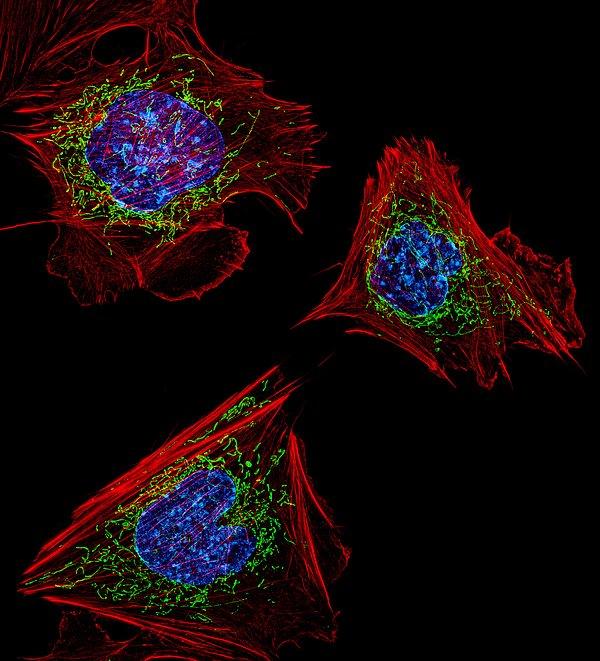 Beşincilik Ödülü: Fare embriyonik fibroblansları. Aktin filamanlar (kırmızı), mitokondri (yeşil) ve DNA (mavi)