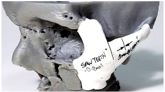 3 Boyutlu Yazıcıyla Yeni Yüz Yapıldı