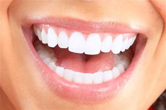Diş Beyazlatma Yöntemleri