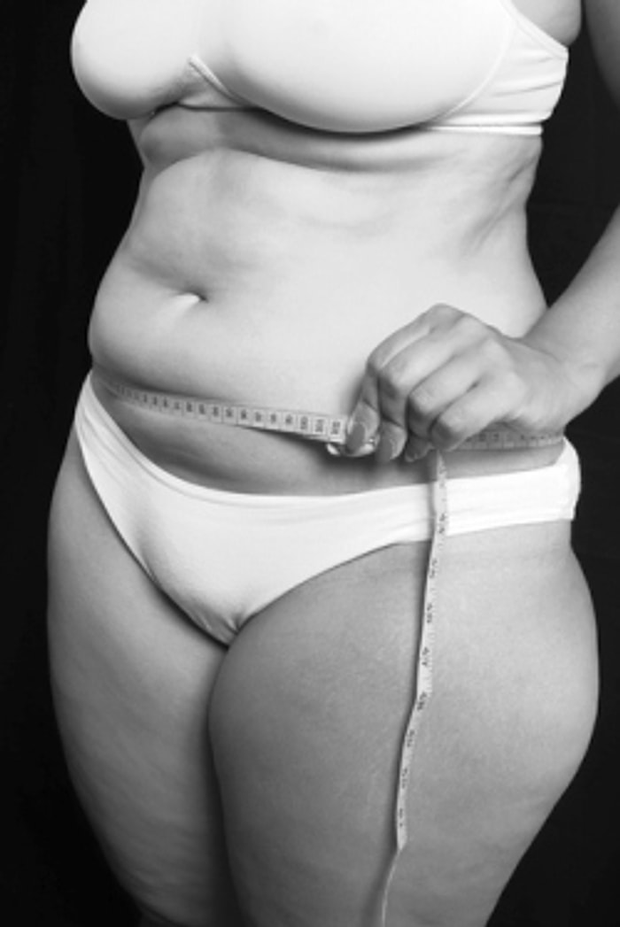 Göbek Bölgesindeki Yağlar Nasıl Erir?