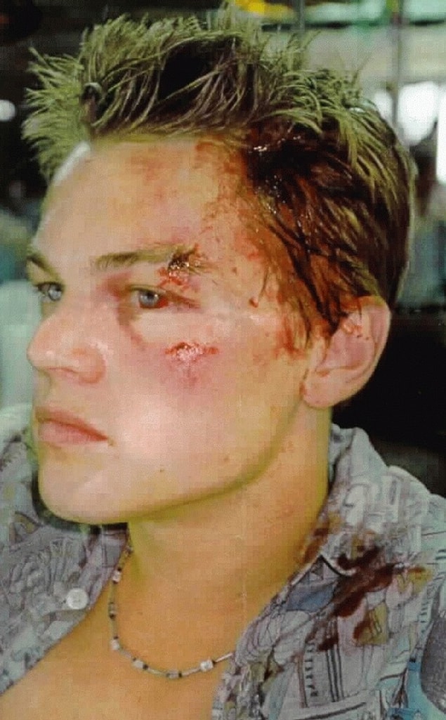 2005'teki bir partide bir kadın tarafından yüzüne şarap kadehi ile darbe aldı.