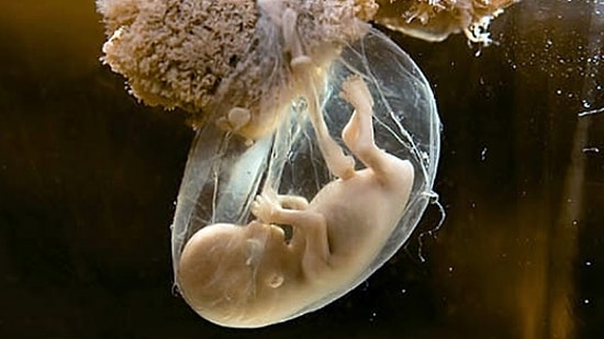 Bir Bebeğin Hayata Tutunuşu