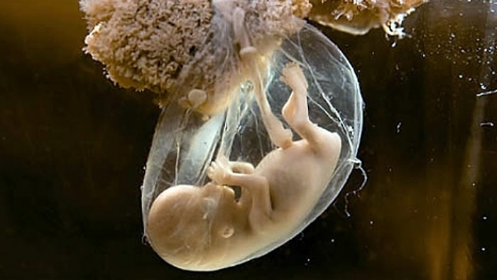 Bir Bebeğin Hayata Tutunuşu