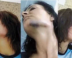 İşkenceyi Örtbas Raporu Hazırlayan Polislere Verilen Ceza Ertelendi