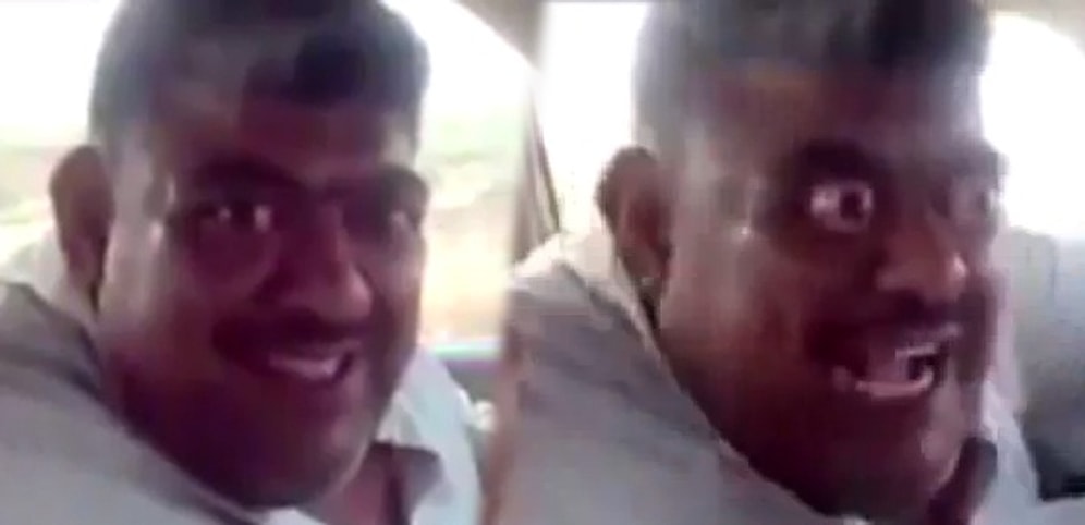 Gözlerini Yuvalarından Çıkaran Adam -Gözlerinize inanamayacaksınız-