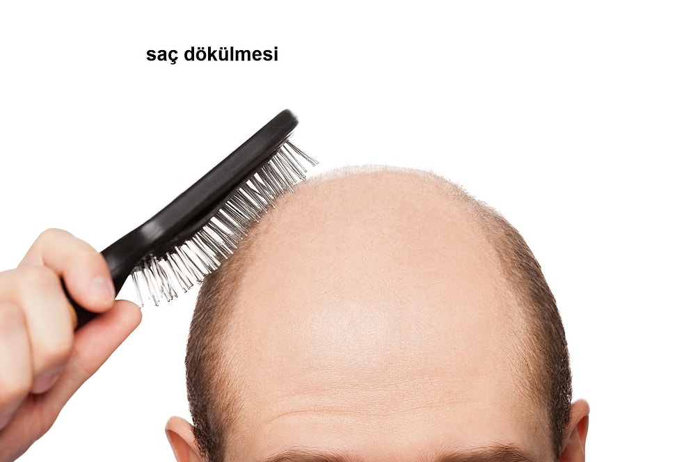 Saç Dökülmesini Durdurmak
