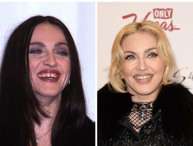 18. Madonna.