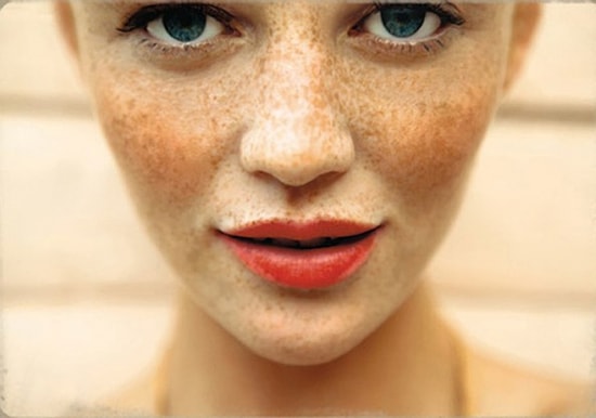 Çillerden Doğal Yöntemlerle Kurtulun