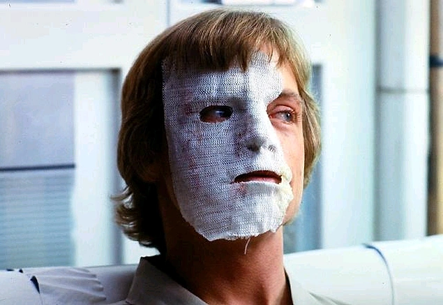 Yaralı yüz Luke Skywalker