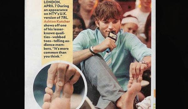 Ashton Kutcher: Bir ayağındaki iki parmağı birleşik
