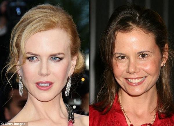 6. Sanırız Nicole Kidman kardeşinden estetik farkıyla daha karizmatik