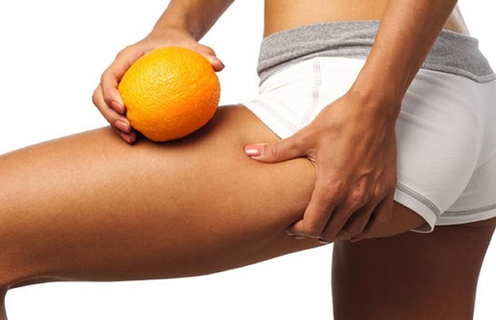 Selülitten Kurtulmak İçin Diyet Yapmak Yeterli mi?