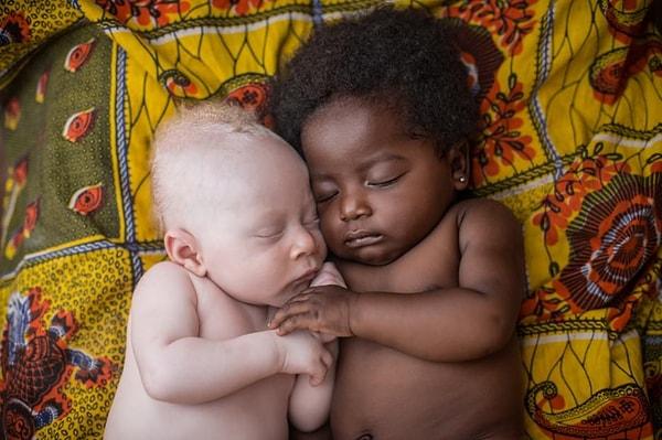 38. 3 haftalık albino bebek, kuzeniyle birlikte