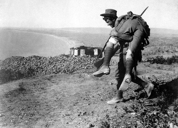 36. Bir Anzak askeri silah arkadaşını hastaneye taşırken, Çanakkale Savaşı, 1915