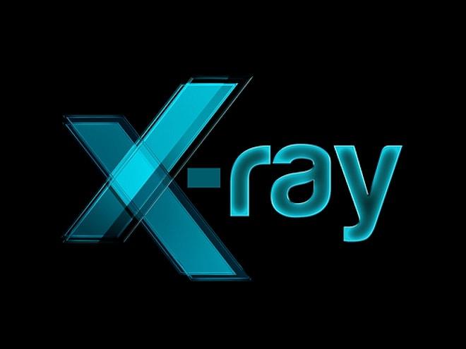 X-Ray Cihazın'da Karşılaşılan En Garip 13 Şey