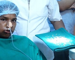 Hindistan'da Doktorlar Bir Gencin 232 Dişini Çekti