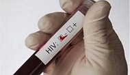 Aids Nedir? Belirtileri Nelerdir? Tedavisi Var Mıdır?