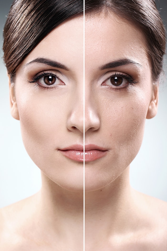 Peeling Nedir ve Ne Zaman Yapılmalıdır?