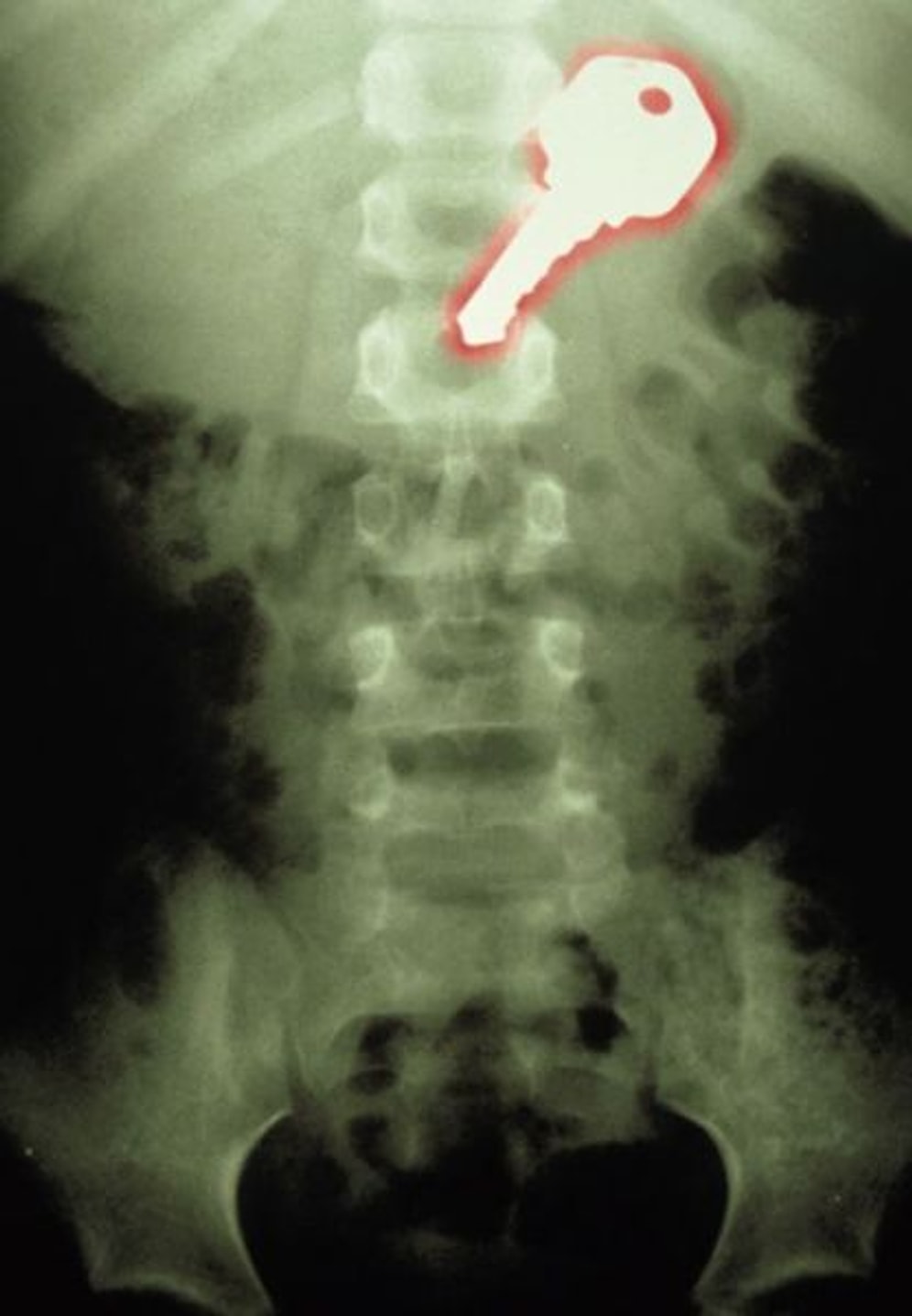 Sizleri Şoka Uğratacak 22 Tuhaf X-Ray Görüntüsü