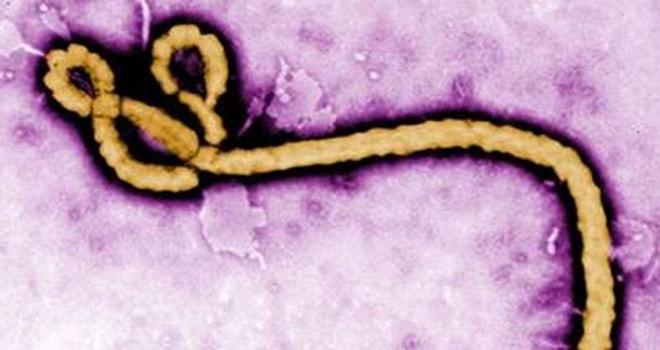 Ebola salgınına karşı uyarı!