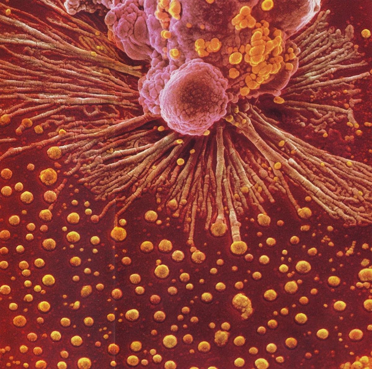 Эритроциты макрофаги. Макрофаг микрофотография. Микрофотография клетки человека. Фагоцит микрофотография. Иммунитет фагоциты.