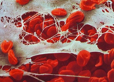 Bağışıklık Sistemimizi Gösteren 16 İnanılmaz Fotoğraf