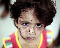 UNICEF: 'Gazze'de 370 Binden Fazla Çocuğun 'Psiko-Sosyal' Yardıma İhtiyacı Var'