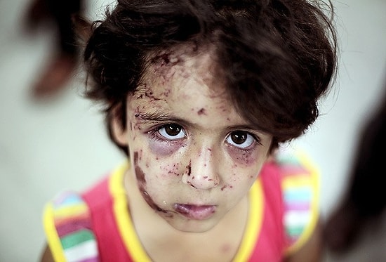 UNICEF: 'Gazze'de 370 Binden Fazla Çocuğun 'Psiko-Sosyal' Yardıma İhtiyacı Var'