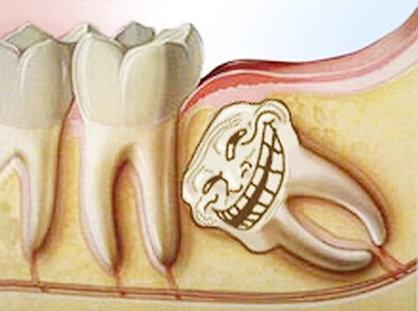 1. Gayet hunharca, dalga geçercesine en beklenmedik zamanda kapınızı çalan bir ağrıdır.