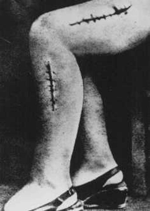 10. 1942'de tıbbî deneylerde kullanılan Ravensbrueck'ten sağ kalan Polonyalı siyasî esir Helena Hegier'in deforme olmuş bacağının savaş suçları tahkikatı sırasında incelenmesi. Bu fotoğraf, Nuremberg'deki Tıbbî Dava'da iddia makamı tarafından kanıt olarak sunuldu. Ensizyon sonucu bacağın şekil değiştiren yaralarına tıbbî personel tarafından bilerek bakteri, pislik ve cam parçaları ile enfekte edildi.