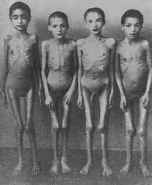11. Auschwitz-Birkenau'da Dr. Josef Mengele'nin tıbbî deneylerde kullandığı kurbanlar.