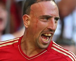 Bayern'de Ribery Şoku