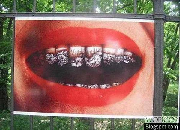 7. Her gün onlarca insanın sararmış dişlerine odaklanmamaya çalışırsın.