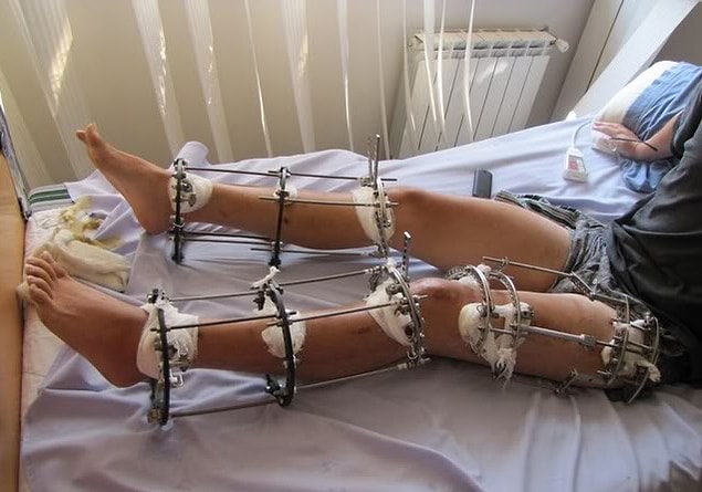 8. Leg extensions