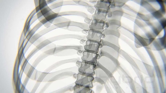 Yoga Yaparken Kemiklerimiz Böyle Görünüyor