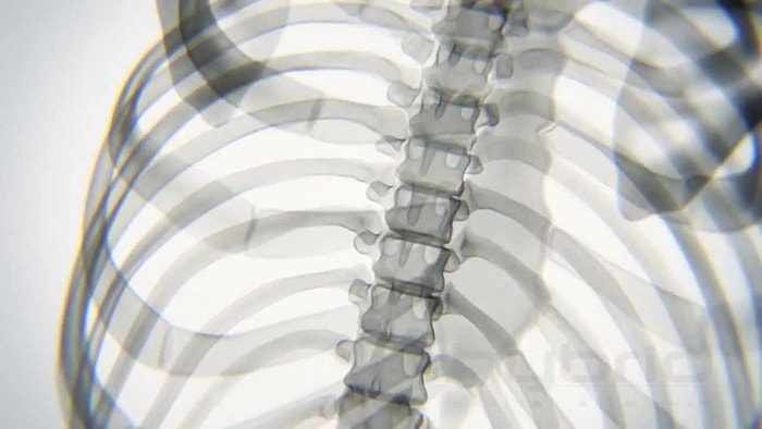 Yoga Yaparken Kemiklerimiz Böyle Görünüyor