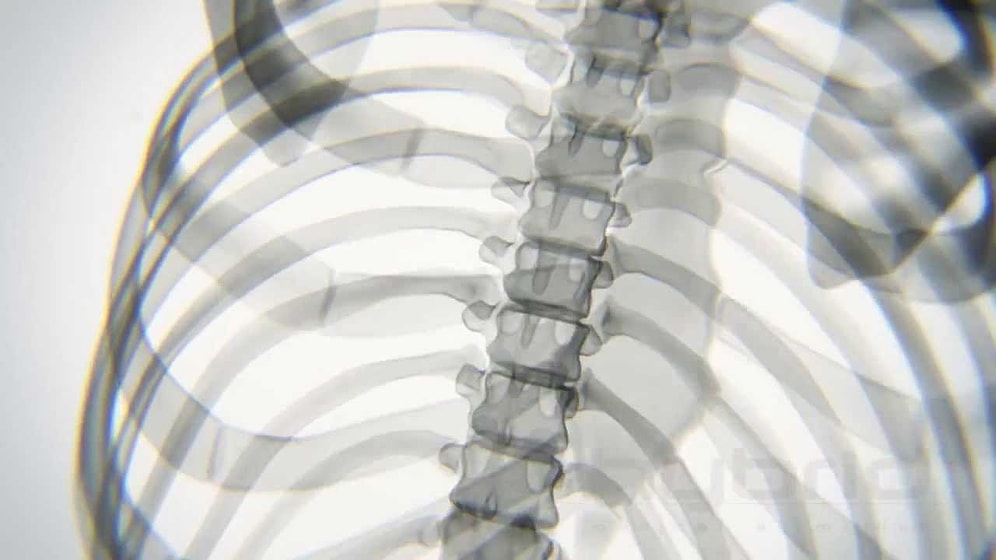 Yoga Yaparken Kemiklerimiz Böyle Görünüyor