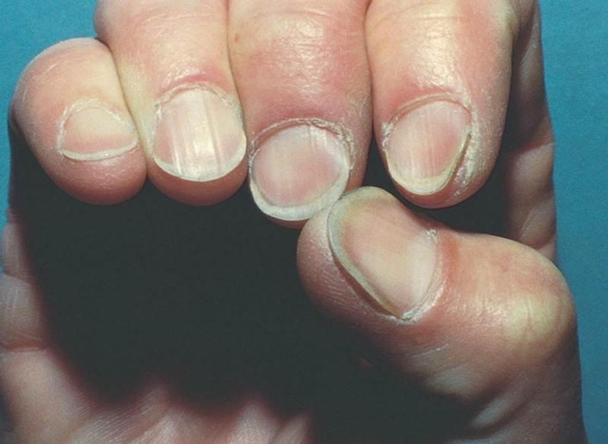 Ногти на больших пальцев мужчин