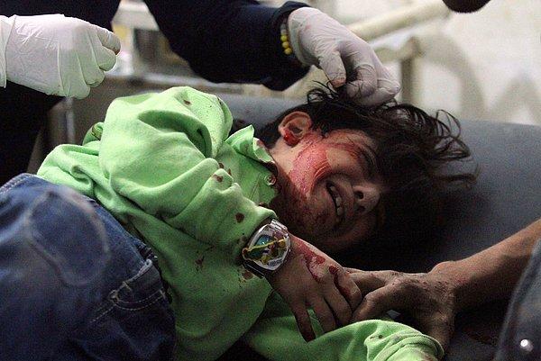 8. Aktivistlerin Beşşar Esad'ın güçleri tarafından düzenlenen hava saldırısı sırasında yaralandığını söyledikleri çocuk sahra hastanesinde tedavi görüyor. Duma, Şam, Suriye. 20 Ekim