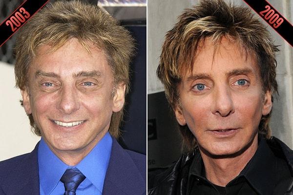 1. Barry Manilow