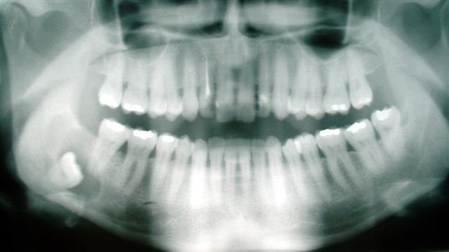 3- Körelmiş Organlar Neden Doğru Değildir?